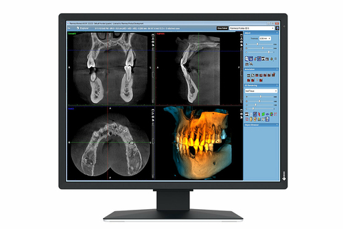 2MP EIZO RADIFORCE MX217-SB 21IN DIAGNOSTIC DISPLAY SELFQC